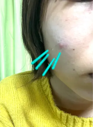 出張鍼灸師 miyuのエステ・リラクイメージ