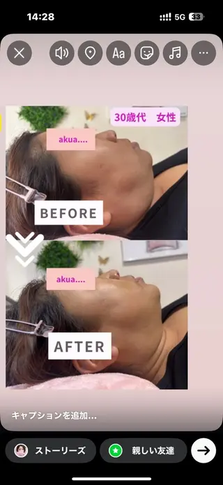 akua... 【肌質管理専門】のその他イメージ