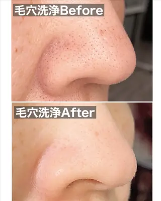 メディカルサロンドオフ所属・ハリサロンドオフ 美容鍼灸×小顔整体のエステ・リラクイメージ