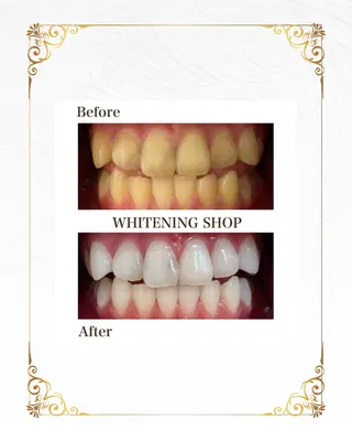 ホワイトニングショップ静岡葵区店所属・ホワイトニング ショップ葵区静岡駅店のその他イメージ