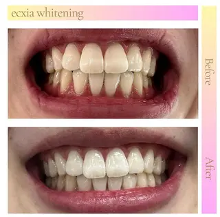 セルフホワイトニング エクシア武蔵小杉店のその他イメージ