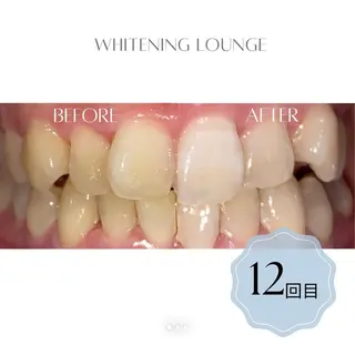 ホワイトニングラウンジ横須賀所属・ホワイトニング Lounge横須賀のその他イメージ