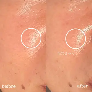 フェイシャル専門店　regalo所属・フェイシャル専門店 regaloのエステ・リラクイメージ