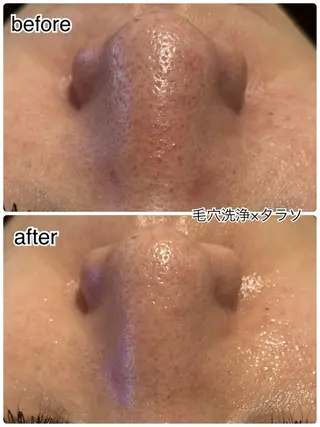 ENCHANT 脱毛.小顔.毛穴のエステ・リラクイメージ