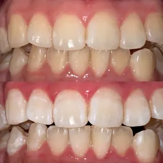 ホワイトニングサロンaile所属・セルフホワイトニング 金城しおりのその他イメージ