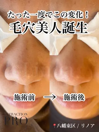 Private salon Linoa所属・プライベートサロン Linoaのマツエク・マツパデザイン