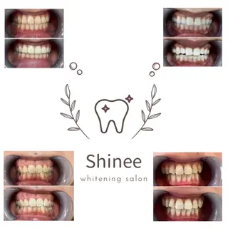 セルフホワイトニング Shineeのエステ・リラクイメージ