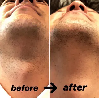 メンズ 脱毛／眉毛 BOSS 森山晴都の眉毛・アイブロウイメージ