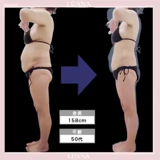 脱毛・小顔専門サロンLUANA所属・脱毛&シェービング 専門店 平岡のその他イメージ