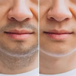 メンズ 美肌フェイシャル・美肌脱毛 Di cuore所属・美肌専門 Di  cuoreのエステ・リラクイメージ