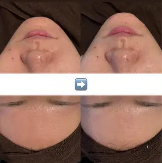 韓国肌管理Belle赤羽所属・韓国肌管理Belle 赤羽のエステ・リラクイメージ