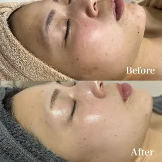 𝐌𝐚𝐜𝐡𝐞 𝐛𝐲 𝐌𝐚𝐲𝐮所属・ハーブピーリング🌿 𝑴𝒂𝒚𝒖のエステ・リラクイメージ