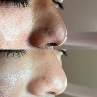 毛穴ケア・ヘッドスパサロンSHINY(シャイニー)所属・毛穴ケア・ヘッドスパ サロンSHINYのエステ・リラクイメージ