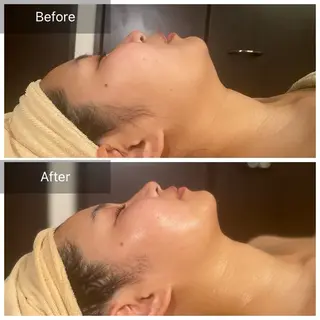 Mandarin Orange所属・毛穴から始める肌メン テマンダリンオレンジのエステ・リラクイメージ