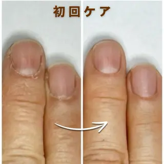 ネイル Tolano nailcareのネイルデザイン
