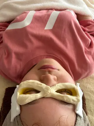 鍼灸•マッサージサロンCalfa所属・《美肌･小顔》美容鍼 ＆マッサージ＊MEIのエステ・リラクイメージ