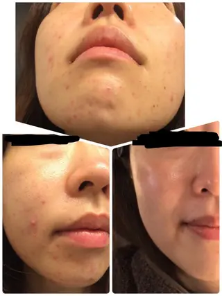 Salon Ameliliyのエステ・リラクイメージ