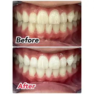 メンズ キッズ プラチナムビューティー柏所属・【歯科提携】柏ホワイ トニングスタイルのその他イメージ