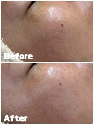 Param所属・Param Femcareのエステ・リラクイメージ