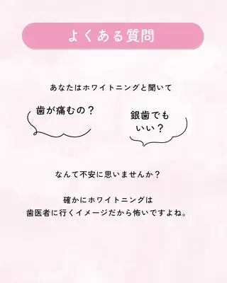 セルフホワイトニング エクシア大曽根店のその他イメージ