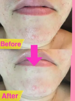 痩身リンパダイエット 隠れ家サロンチャームのエステ・リラクイメージ