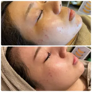 yellow.所属・yellow💛【 脱毛&フェイシャル】のエステ・リラクイメージ