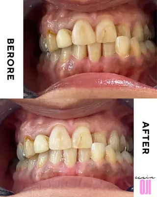 セルフホワイトニングサロン  エクシアホワイト 王寺店所属・エクシア王寺 NISHIKAWAのその他イメージ