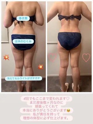 本気で痩せたい方へ 痩身専門サロンのその他イメージ