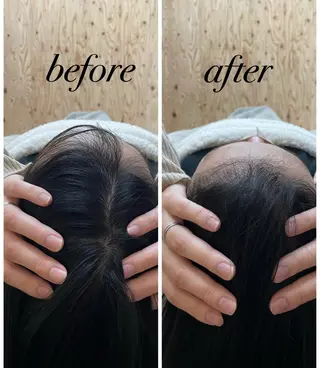 ate'所属・個室ドライヘッドスパ 🍃moriのエステ・リラクイメージ