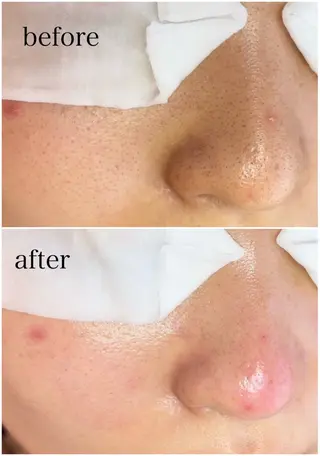 姫路/毛穴専門店 'AMOのエステ・リラクイメージ