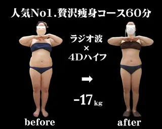 痩身・小顔・脱毛 グレイスボディのエステ・リラクイメージ