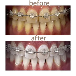 メンズ ホワイトニング ショップ船橋2号店のエステ・リラクイメージ