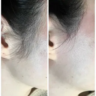 Nail & 高速脱毛 avenir【アヴニール】所属・WAX/眉/光脱毛 🌿リラク/小顔のエステ・リラクイメージ