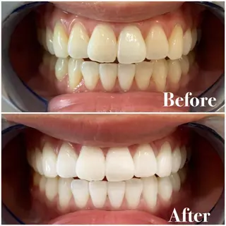 ロング カラー パーマ ヘアアレンジ メンズ キッズ ネイル マツエク・マツパ ライトビューティー 錦糸町店のエステ・リラクイメージ