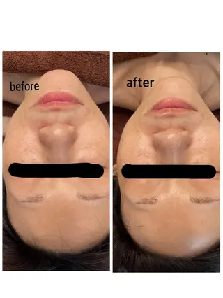 mignonneミニョンヌ*所属・mignonne ミニョンヌのエステ・リラクイメージ