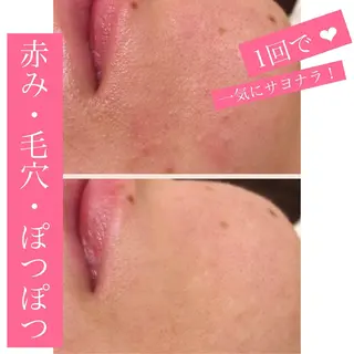 ミディアム カラー パーマ ヘアアレンジ メンズ キッズ ネイル マツエク・マツパ 四つ星サロン🎖 腸＆ニキビケアに特化のエステ・リラクイメージ