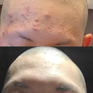 メンズ DahliaBeauty ダリアビューティー所属・Dahlia痩身脱毛 フェイシャル 中村のエステ・リラクイメージ