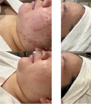 beautysalon FourV所属・名駅🌼無痛美肌脱毛 /フェイシャルのエステ・リラクイメージ