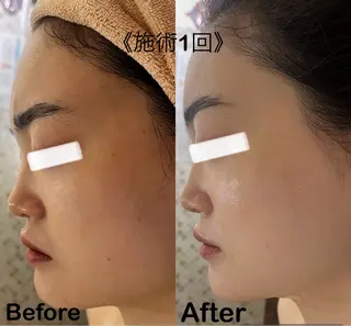 小顔&美肌品川店 Masqueradeのエステ・リラクイメージ