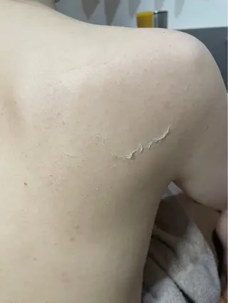 clé skin 🌿ハーブピーリングのエステ・リラクイメージ