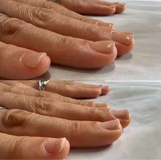 ネイル 深爪矯正専門店ネイルサロンKUU所属・深爪矯正専門店 ネイルサロンKUUのネイルデザイン