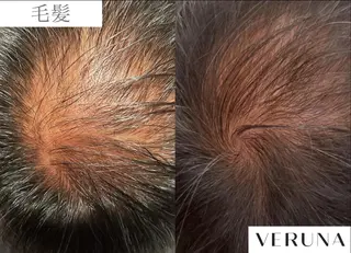 業界初の頭皮ケア 棘スカルプLUNEAのヘアスタイル