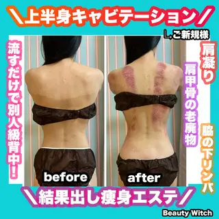 痩身/脱毛/ネイル HARUKAのエステ・リラクイメージ