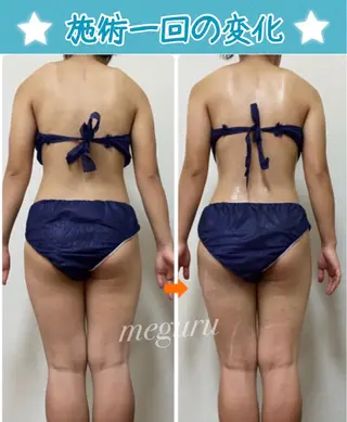 ショート カラー パーマ ヘアアレンジ メンズ キッズ ネイル マツエク・マツパ ‍痩身＆ボディ 結果出し🌟丹野のエステ・リラクイメージ