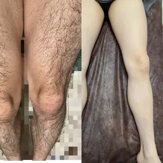 メンズ Luce所属・LUCE メンズ脱毛のエステ・リラクイメージ