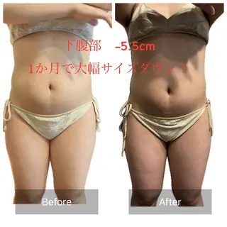 腸活/クビレを作る /痩身エステのエステ・リラクイメージ
