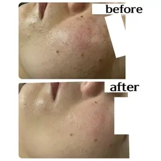 Dione湘南藤沢店 ×LUANA　齋藤のエステ・リラクイメージ