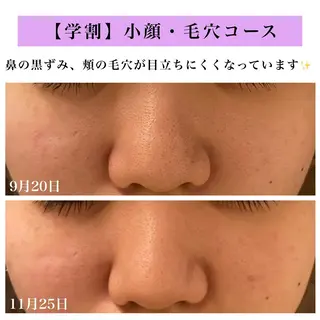 Bellesthe (ベルエステ)のエステ・リラクイメージ