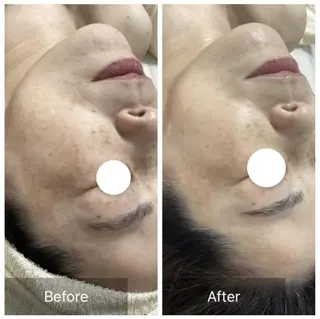 Dahlia Moriのエステ・リラクイメージ