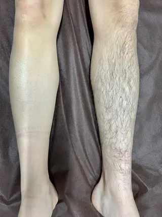 メンズ SOLUNA(ソルーナ)所属・SOLUNA 💛staffのエステ・リラクイメージ